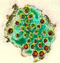 Noro virussen en glijzeilen